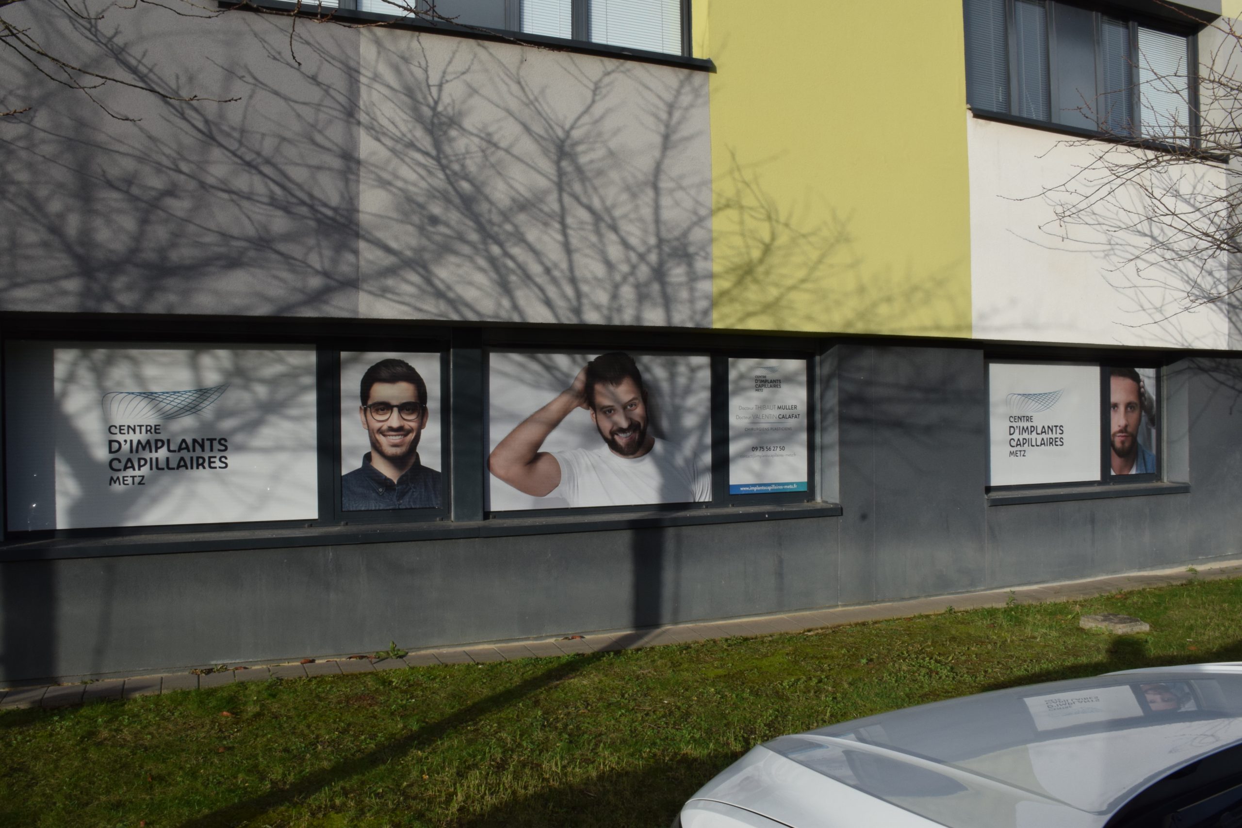 Valentin Matz Prendre rendez-vous - Centre d'Implants Capillaires de Metz